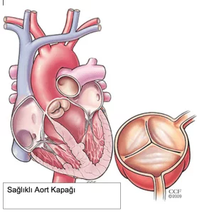 Sağlıklı Aort Kapağı